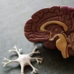 Diagnosis and Management of Posterior Cortical Atrophy from an Eye Care Perspective
