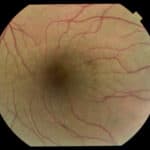 An Ocular Review on Commonly Used Substances