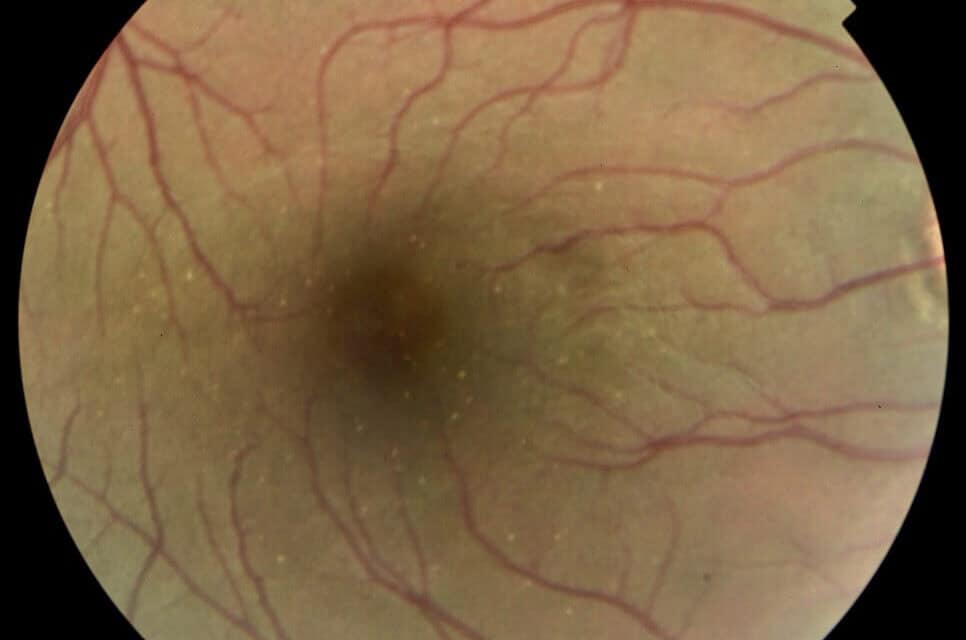 An Ocular Review on Commonly Used Substances
