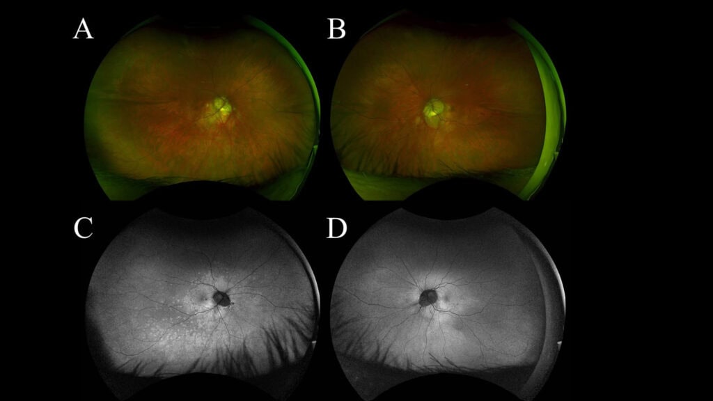 fig1(1)