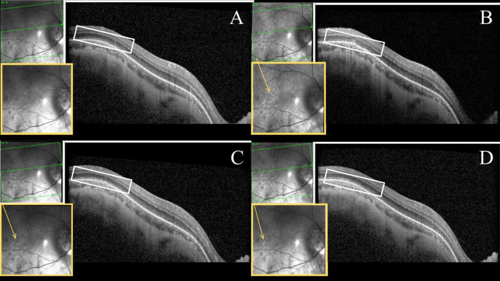 fig2(1)