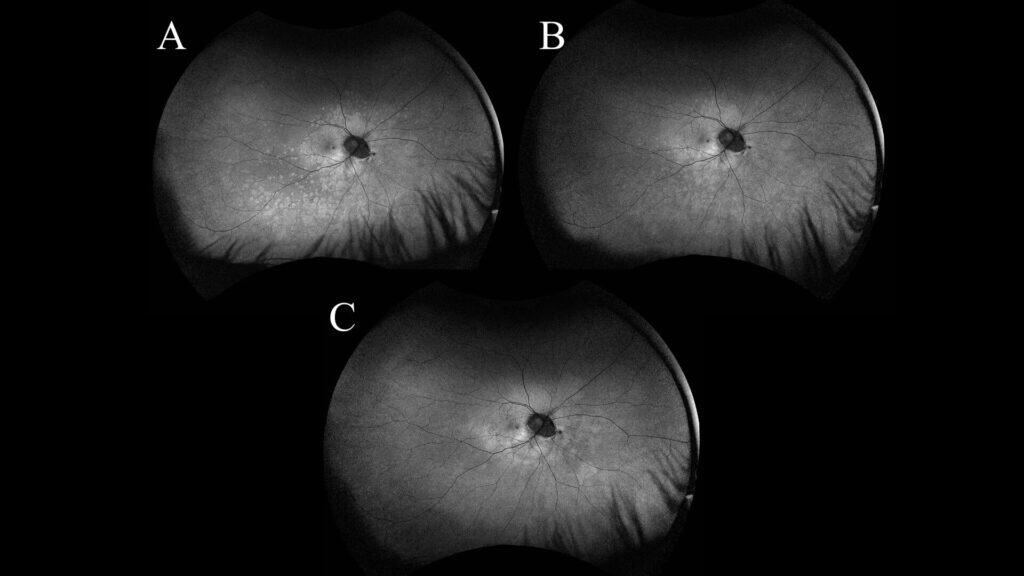 fig3(1)