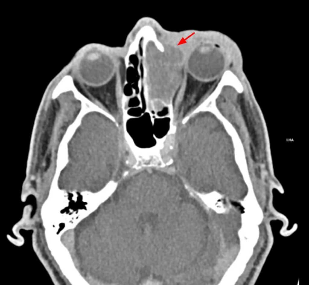 fig 3 (large) (1)