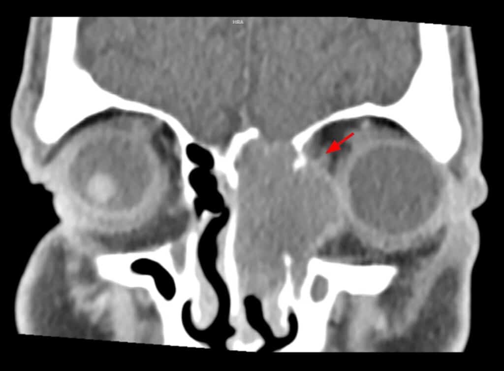 fig 4 (large) (1)