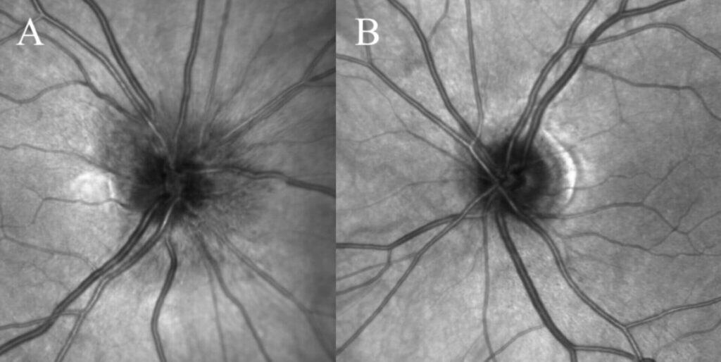 fig 5 ir naion (large) (1)