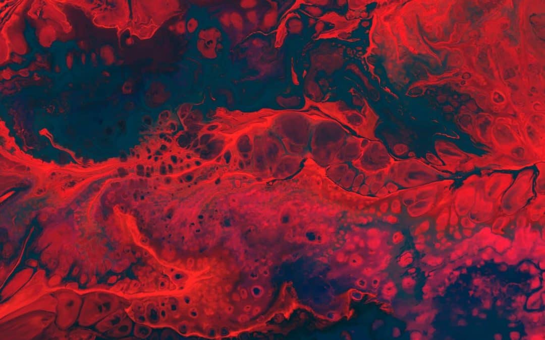 Neovascular Glaucoma: A Case Report and Literature Review