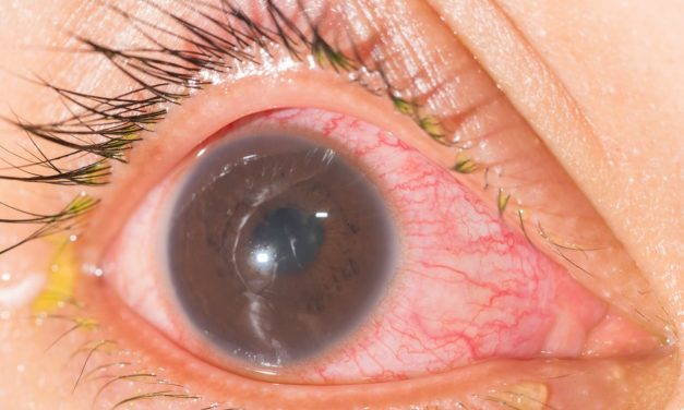 Uveitis: Laboratory Investigations and Current Recommendations on Diagnosis
