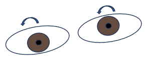 skew figure 3(1)