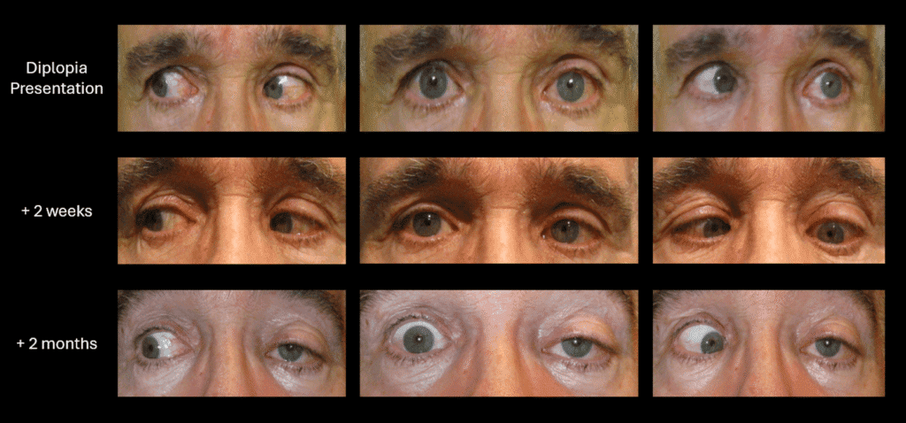 figure 7 eom