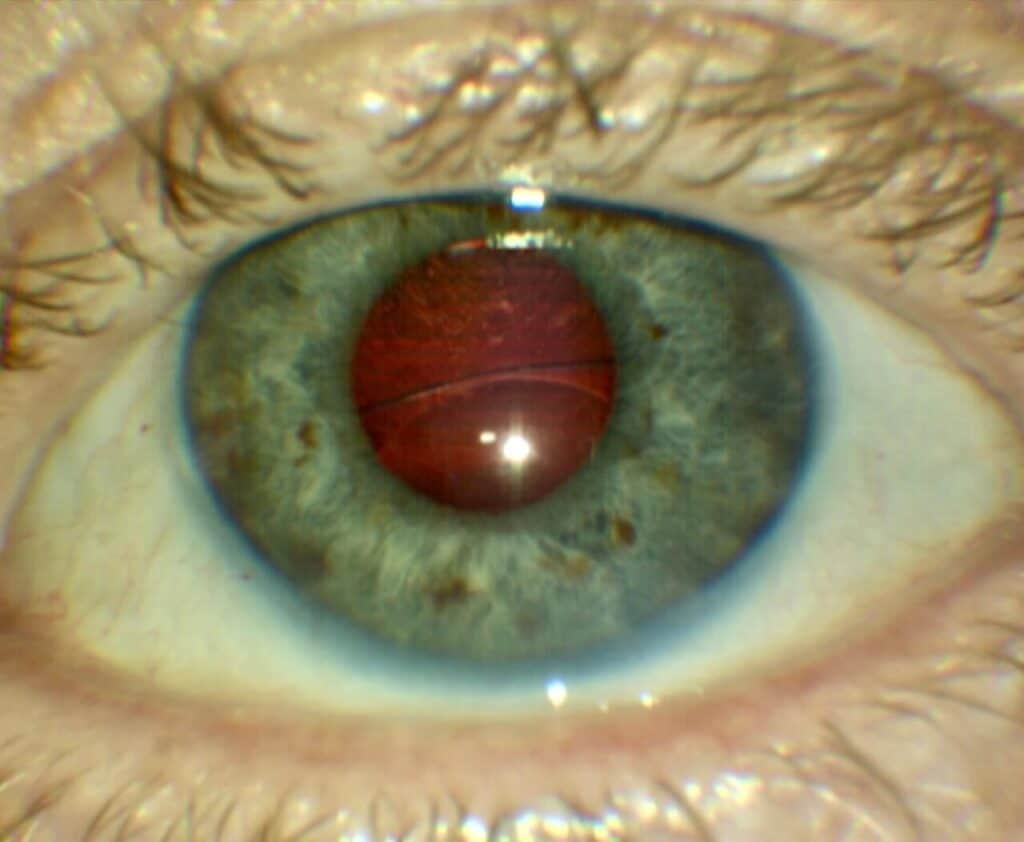 diplopia detective fig 1 bright(2)