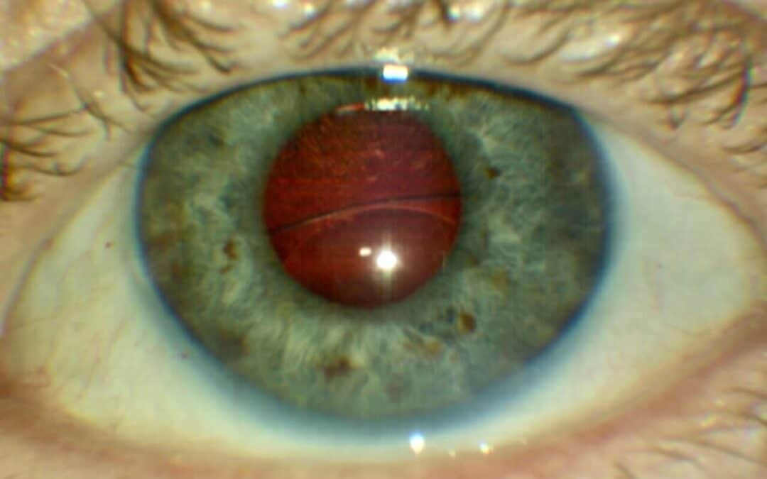 Diplopia Detective – Case 2