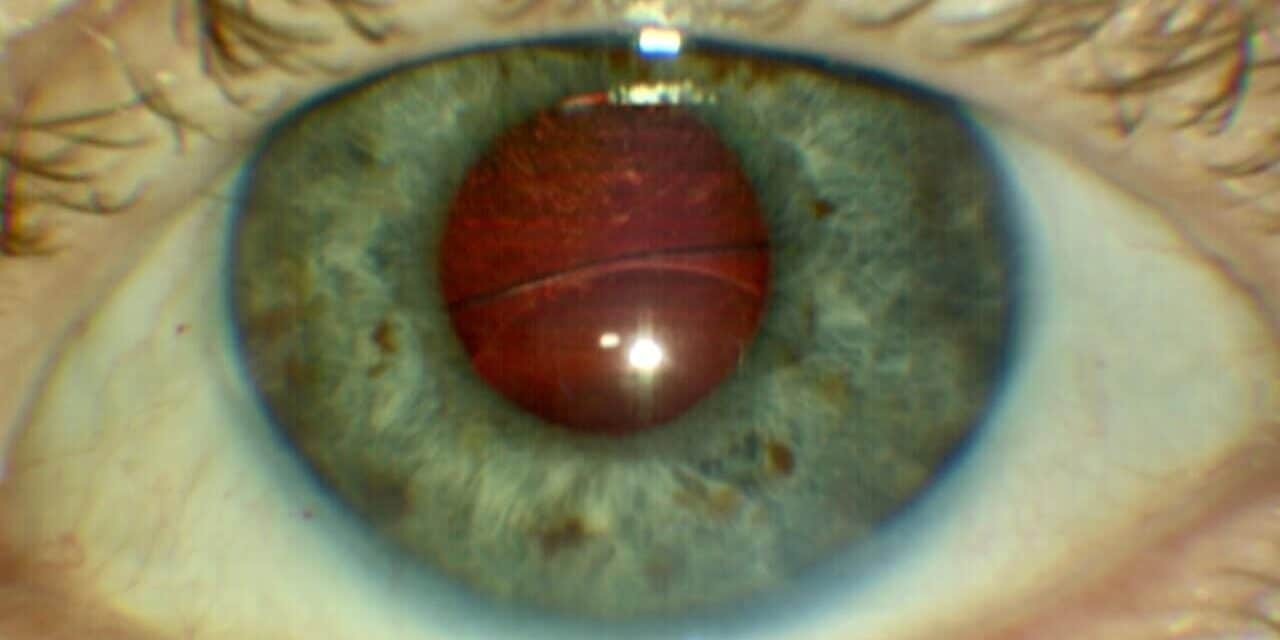 Diplopia Detective – Case 2