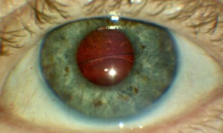 Diplopia Detective – Case 2