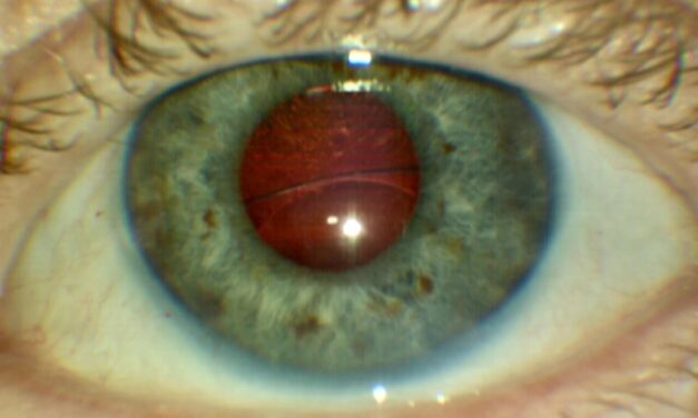 Diplopia Detective – Case 2