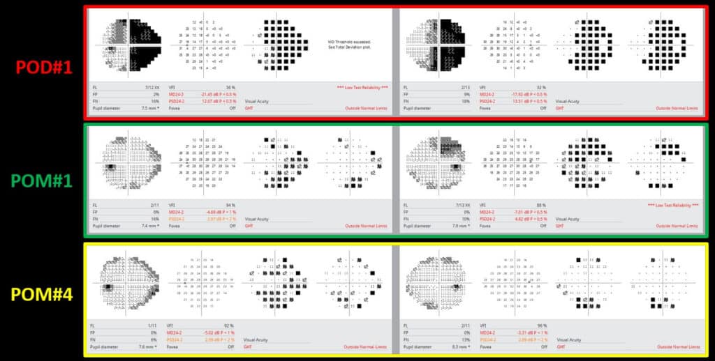 neuro nuggets fig 2(1)