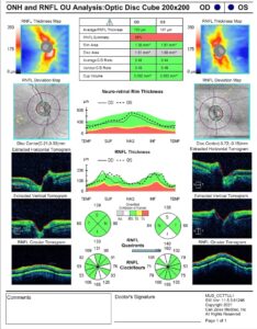 Diagnosis and Management of Posterior Cortical Atrophy from an Eye Care ...
