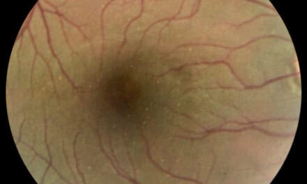 An Ocular Review on Commonly Used Substances