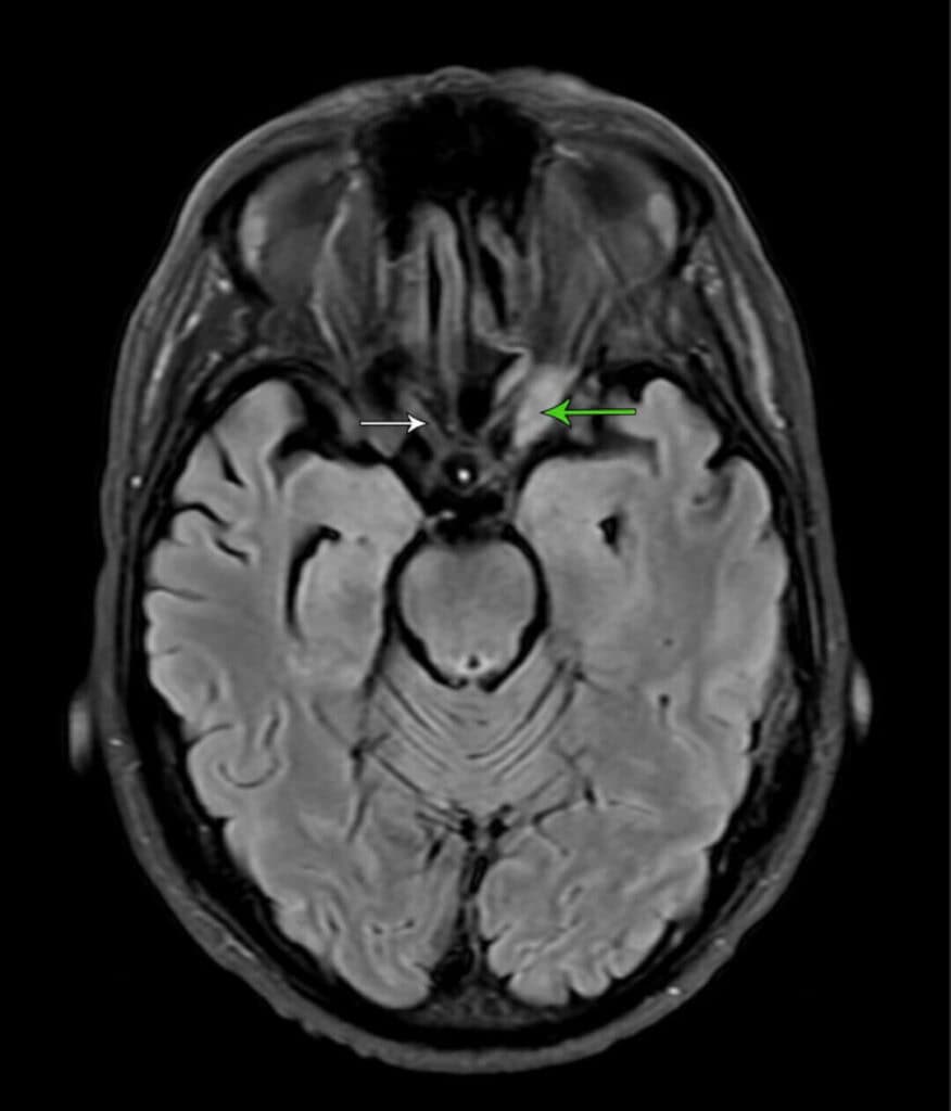 pc figure 6 (large) (1)