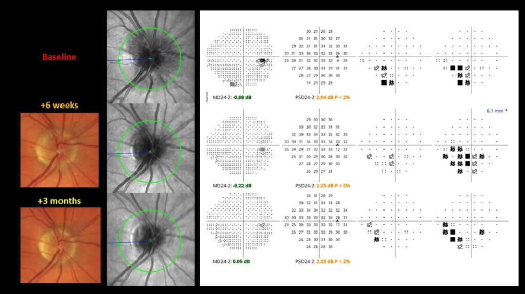 fig 6 serial testing naion (large) (1)