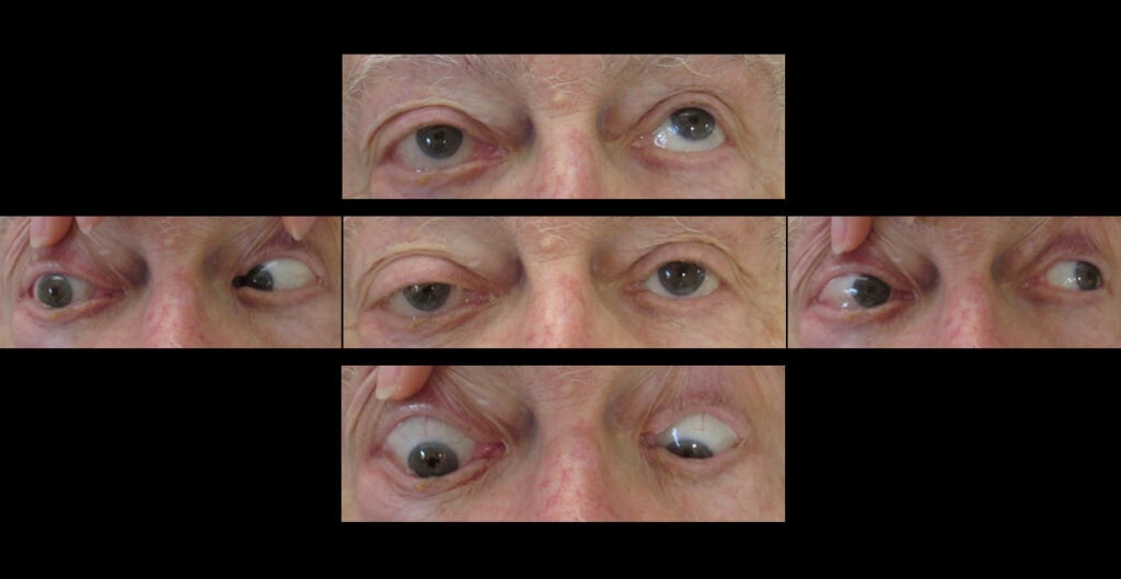 fig 1 nn