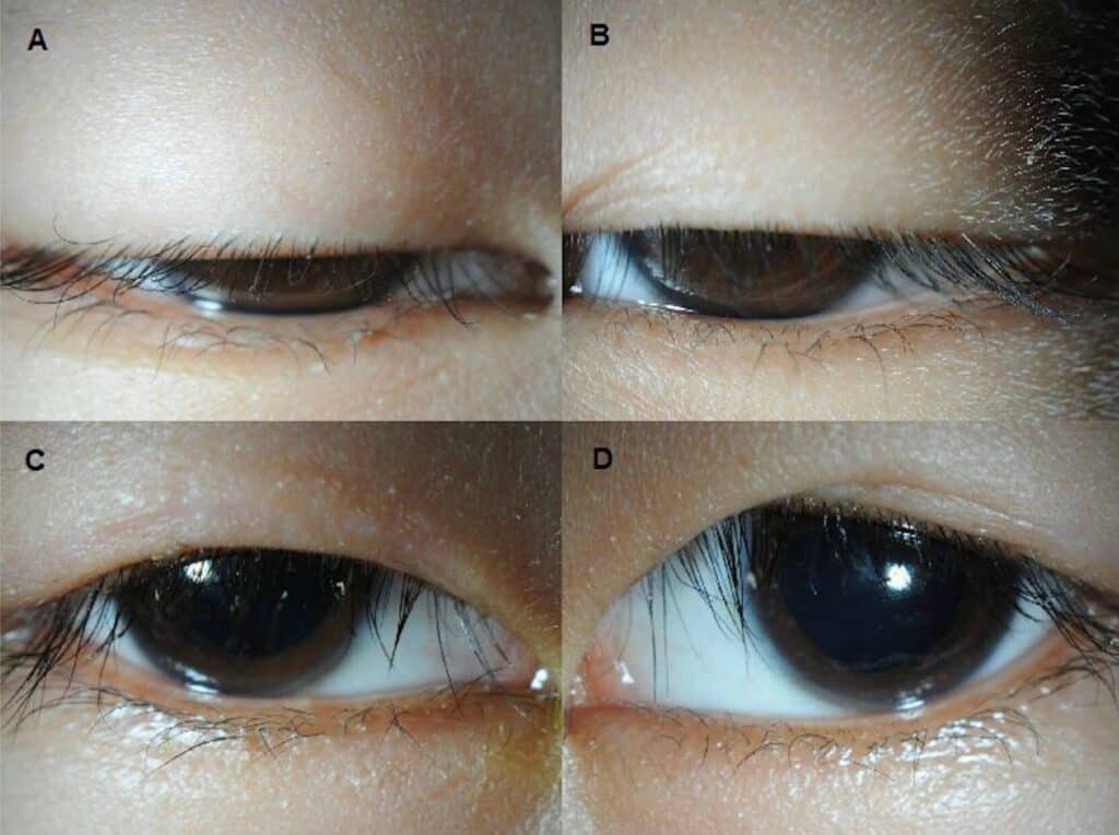 fig 3 kss (1)
