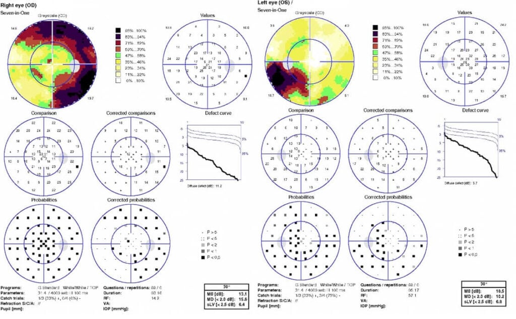fig 4 kss (1)